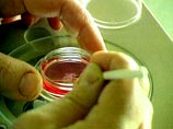 Турецкие ученые создали лекарство, которое за минуты останавливает любое кровотечение Турецкие ученые создали лекарство, которое за минуты останавливает любое кровотечение