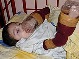 В сербских психбольницах дети, привязанные к колыбелям, грызут свои руки В сербских психбольницах дети, привязанные к колыбелям, грызут свои руки