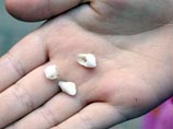 Японские ученые из университета Нагоя объявили об открытии банка молочных зубов Японские ученые из университета Нагоя объявили об открытии банка молочных зубов