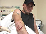 Австралиец, якобы голыми руками отбившийся от акулы, оказался лжецом и преступником