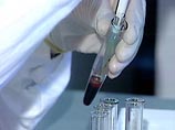 Россия потратит 1 млрд рублей на исследования в сфере борьбы с ВИЧ в ближайшие три года Россия потратит 1 млрд рублей на исследования в сфере борьбы с ВИЧ в ближайшие три года