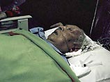Состояние здоровья бывшего президента Индонезии Сухарто, находящегося в реанимации в одной из больниц Джакарты, несколько улучшилось, он пришел в сознание, сообщили сегодня лечащие его медики