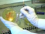 Как сообщил Медицинский центр университета Утрехта, координировавший проект, в течение 2004-2007 годов 24 человека умерли в ходе исследования воздействия пробиотиков
