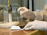 В эфире была продемонстрирована реакция крысы на введение в ее организм крови, зараженной болезнью Гийена-Барре В эфире была продемонстрирована реакция крысы на введение в ее организм крови, зараженной болезнью Гийена-Барре
