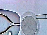 Британские ученые создали человеческий эмбрион от трех родителей: одного мужчины и двух женщин