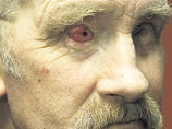 Ирландцу вернули зрение: глаз восстановили с использованием зуба его сына
