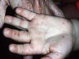 В Китае общенациональная тревога: из-за смертельного вируса уже погибли 25 детей В Китае общенациональная тревога: из-за смертельного вируса уже погибли 25 детей