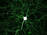 Нервные клетки восстанавливаются: ученые раскрыли механизм их омоложения 