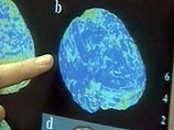 Ученые нашли в мозге человека полосатое тело, отвечающее за тягу к опасностям Ученые нашли в мозге человека полосатое тело, отвечающее за тягу к опасностям