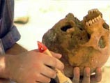 На черепах монахов ученые увидели загадочные повреждения, своим видом напоминающие изменения, вызываемые проказой