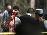 Автомобиль, начиненный взрывчаткой, был припаркован поблизости от здания индийской дипмиссии Автомобиль, начиненный взрывчаткой, был припаркован поблизости от здания индийской дипмиссии