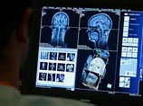 Французские нейрохирурги научились убивать раковые клетки с помощью лазера