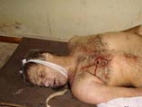 В рамках уголовного дела, возбужденного Генпрокуратурой Республики Южная Осетия по факту геноцида со стороны Грузии, эксгумированы и идентифицированы тела 276 погибших В рамках уголовного дела, возбужденного Генпрокуратурой Республики Южная Осетия по факту геноцида со стороны Грузии, эксгумированы и идентифицированы тела 276 погибших