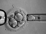 В России начали практиковать методику генетической диагностики эмбрионов