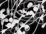 Ученые смогли создавать стволовые клетки из незрелых клеток человеческой спермы