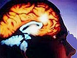 Ученые: мозг человека начинает разрушаться в 39 лет,  сразу после пика умственной активности