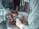 В Косово разоблачена преступная группа врачей, занимавшаяся нелегальной пересадкой органов В Косово разоблачена преступная группа врачей, занимавшаяся нелегальной пересадкой органов