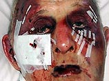 Британские грабители жестоко избили 89-летнего ветерана Второй мировой войны и его жену Британские грабители жестоко избили 89-летнего ветерана Второй мировой войны и его жену