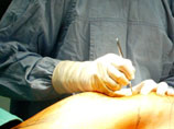 Пластический хирург из Беверли-Хиллз ездил на биотопливе из человеческого жира