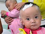 В начале сентября в Китае стали известны факты заболевания малолетних детей мочекаменной болезнью
