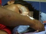 В Боливии от лихорадки денге скончались 19 человек В Боливии от лихорадки денге скончались 19 человек
