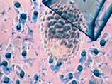 До сих пор для получения искусственных, или индуцированных плюрипотентных стволовых клеток из клеток кожи ученые использовали генетически модифицированные вирусы