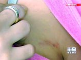 В Австралии 6 игроков команды по регби изнасиловали умственно отсталую поклонницу В Австралии 6 игроков команды по регби изнасиловали умственно отсталую поклонницу