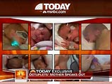В США из больницы во вторник вечером выписали двух из восьми близнецов, которых 26 января родила 33-летняя Надя Сулеман