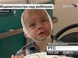 В органах опеки города Видное считают, что с мальчиком, которого до полусмерти избила мать, произошел несчастный случай В органах опеки города Видное считают, что с мальчиком, которого до полусмерти избила мать, произошел несчастный случай