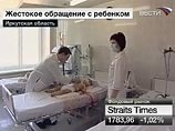 Двухлетний Никита Чемезов сейчас находится между жизнью и смертью, говорят врачи Двухлетний Никита Чемезов сейчас находится между жизнью и смертью, говорят врачи