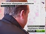 В Иркутской области мать и отчим-зэк целый месяц жестоко избивали двухлетнего малыша. Ребенок при смерти В Иркутской области мать и отчим-зэк целый месяц жестоко избивали двухлетнего малыша. Ребенок при смерти