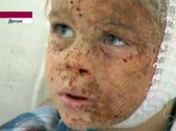 Приемную мать четырехлетнего Глеба Агеева официально обвинили в истязании ребенка Приемную мать четырехлетнего Глеба Агеева официально обвинили в истязании ребенка