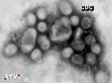 Российские медики ждут от американских специалистов образцы штаммов опасного гриппа H1N1, чтобы провести собственные исследования в национальных центрах