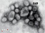 Число заболевших гриппом A/H1N1 превысило в США 400 человек, вирус грозит охватить всю страну
