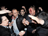 По последним данным, 23 пострадавших в результате столкновений остаются в тбилисских больницах. Очевидцы происходящего утверждают, что спецназ применил резиновые пули, чтобы заставить сторонников оппозиции отойти от входа в здание