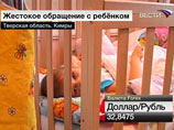 В истязании двухлетней девочки, попавшей в больницу в Тверской области, обвинят гражданского мужа опекунши