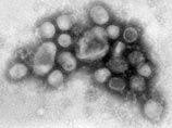 Из американского штата Атланта в четверг в Москву были доставлены образцы нового штамма вируса гриппа A/H1N1, который также называют "свиным гриппом"