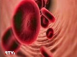 Отмечены случаи, когда иммунофлюоресценция (метод определения количества антител или антигенов в тканевом срезе) определяет вирус А, но не может классифицировать его подтип Отмечены случаи, когда иммунофлюоресценция (метод определения количества антител или антигенов в тканевом срезе) определяет вирус А, но не может классифицировать его подтип
