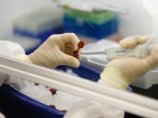 В Канаде насчитывается 719 заболевших гриппом A/H1N1 В Канаде насчитывается 719 заболевших гриппом A/H1N1