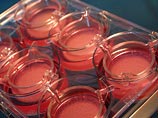 Немецкие ученые синтезировали человеческую кожу и хотят наладить ее производство Немецкие ученые синтезировали человеческую кожу и хотят наладить ее производство