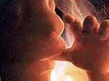 По убеждению организаторов акции, человек должен иметь право на жизнь с момента зачатия