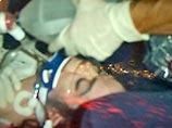 Возможная причина смерти - передозировка обезболивающих Возможная причина смерти - передозировка обезболивающих