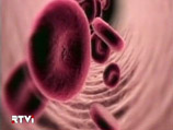 У жительницы Сахалина подтвердился диагноз А/H1N1 У жительницы Сахалина подтвердился диагноз А/H1N1