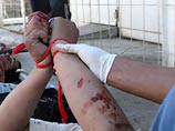 В Ираке массово убивают мужчин, заподозренных в гомосексуализме В Ираке массово убивают мужчин, заподозренных в гомосексуализме