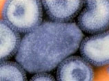Общее число лабораторно подтвержденных случаев заболеваний людей, вызванных вирусом А/H1N1 в мире составляет 251 тысяч 461