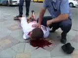 Конфликт между Романом Романчуком и жителем Владивостока Мешковым произошел утром 28 июля 2008 года около центральной площади города. В ходе ссоры Мешков из травматического пистолета выстрелил в голову боксера
