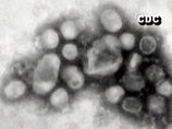 "Живую" вакцину от гриппа A/H1N1 исследуют в Санкт-Петербурге. Онищенко доволен превентивными мерами "Живую" вакцину от гриппа A/H1N1 исследуют в Санкт-Петербурге. Онищенко доволен превентивными мерами