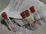 Испытания вакцины от ВИЧ впервые подтвердили ее эффективность
