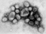 В Белгородской области от свиного гриппа умерла женщина
