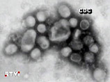 Всемирная организация здравоохранения подтвердила уже 39 случаев заражения вирусом, устойчивым к озельтамивиру